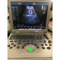 DW-C60plus portátil 3D 4D color doppler máquina de ultrasonido con aprobación CE